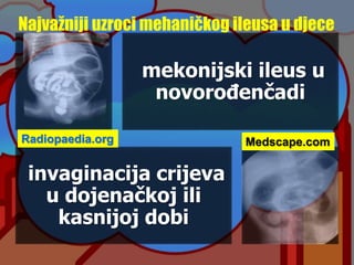Najvažniji uzroci mehaničkog ileusa u djece
mekonijski ileus u
novorođenčadi
invaginacija crijeva
u dojenačkoj ili
kasnijoj dobi
Radiopaedia.org Medscape.com
 