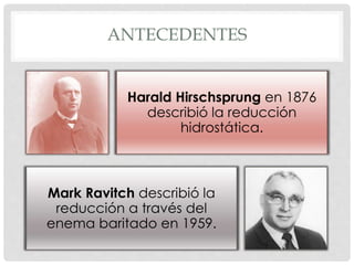 Mark R Ravich Invaginación intestinal | PPSX