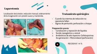 Tratamiento quirúrgico
• Cuando los intentos de reducción no
operatoria fallan
• Signos de peritonitis, perforación o choque
Preparación previa:
1. Canalización y reposición de líquidos
2. Sonda nasogástrica y vesical
3. Antibióticos de alto espectro: Cefalosporinas
3ra generación + Metronidazol (perforación)
Laparotomía
Localización de la lesión, reducción manual, ordenamiento
de la invaginación con presión suave y mantenida.
RECIDIVA 1-4 %
 