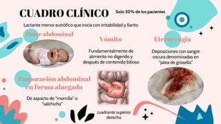 CUADRO CLÍNICO
Dolor abdominal
Deposiciones con sangre
oscura denominadas en
“jalea de grosella”
Fundamentalmente de
alimento no digerido y
después de contenido bilioso
Lactante menor eutrófico que inicia con irritabilidad y llanto
Tumoración abdominal
en forma alargada
De aspacto de “morcilla” o
“salchicha”
Vómito Eterorragia
cuadrante superior
derecho
Solo 30% de los pacientes
 