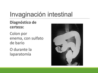 Invaginación intestinal
Diagnóstico de
certeza:
Colon por
enema, con sulfato
de bario
O durante la
laparatomía
 