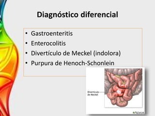 Diagnóstico diferencial
• Gastroenteritis
• Enterocolitis
• Divertículo de Meckel (indolora)
• Purpura de Henoch-Schonlein
 