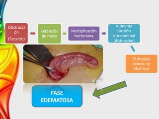 Obstrucci
ón
(Fecalito)
Retención
de moco
Multiplicación
bacteriana
Aumenta
presión
intraluminal
(distensión)
El drenaje
venoso se
obstruye
FASE
EDEMATOSA
 