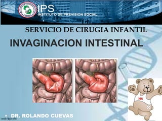 INVAGINACION INTESTINAL
• DR. ROLANDO CUEVAS
SERVICIO DE CIRUGIA INFANTIL
 