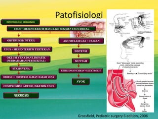 Patofisiologi
Grossfield, Pediatric surgery 6 edition, 2006
 
