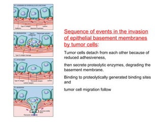 Sequence of events in the invasion
of epithelial basement membranes
by tumor cells:
Tumor cells detach from each other because of
reduced adhesiveness,
then secrete proteolytic enzymes, degrading the
basement membrane.
Binding to proteolytically generated binding sites
and
tumor cell migration follow
 