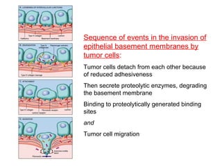 Sequence of events in the invasion of
epithelial basement membranes by
tumor cells:
Tumor cells detach from each other because
of reduced adhesiveness
Then secrete proteolytic enzymes, degrading
the basement membrane
Binding to proteolytically generated binding
sites
and
Tumor cell migration
 