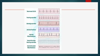Comprehensive Overview of Invasive and Non-Invasive Cardiac Procedures ...