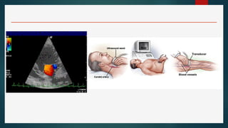 Comprehensive Overview of Invasive and Non-Invasive Cardiac Procedures ...