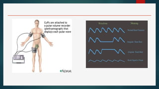 Comprehensive Overview of Invasive and Non-Invasive Cardiac Procedures ...