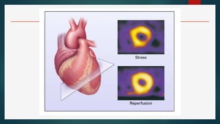 Comprehensive Overview of Invasive and Non-Invasive Cardiac Procedures ...