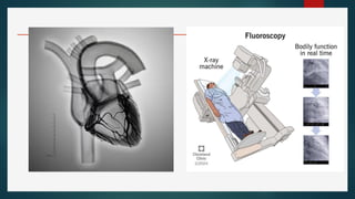 Comprehensive Overview of Invasive and Non-Invasive Cardiac Procedures ...