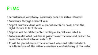 PTMC
• Percutaneous valvotomy- commonly done for mitral stenosis
• Commonly through femoral vein
• Septal puncture done with a special needle to cross from the
right atrium to left atrium
• Septum will be dilated after putting a special wire into LA
• Balloon in deflated position is passed over the wire and pushed to
cross the mitral valve an enter LV
• It will be placed across the narrowed valve and inflated which
results in tear of the mitral commissure and widening of the valve
 