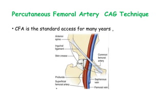 Percutaneous Femoral Artery CAG Technique
• CFA is the standard access for many years ,
 