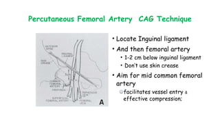 Percutaneous Femoral Artery CAG Technique
• Locate Inguinal ligament
• And then femoral artery
• 1-2 cm below inguinal ligament
• Don’t use skin crease
• Aim for mid common femoral
artery
facilitates vessel entry &
effective compression;
 