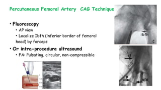 Percutaneous Femoral Artery CAG Technique
• Fluoroscopy
• AP view
• Localize Ibfh (inferior border of femoral
head) by forceps
• Or intra-procedure ultrasound
• FA: Pulsating, circular, non-compressible
 