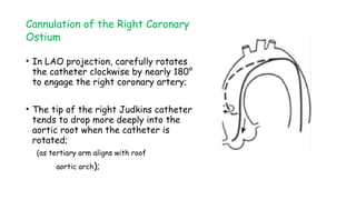 Cannulation of the Right Coronary
Ostium
• In LAO projection, carefully rotates
the catheter clockwise by nearly 180°
to engage the right coronary artery;
• The tip of the right Judkins catheter
tends to drop more deeply into the
aortic root when the catheter is
rotated;
(as tertiary arm aligns with roof
aortic arch);
 
