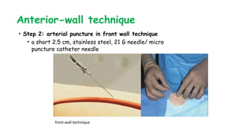 Anterior-wall technique
• Step 2: arterial puncture in front wall technique
• a short 2.5 cm, stainless steel, 21 G needle/ micro
puncture catheter needle
front wall technique
 