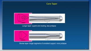 75
Core Taper
Longer taper- superb wire tracking, less prolapse
Shorter taper- longer segments of consistent support, more prolapse
 
