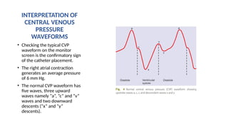 invasivecardiovascularmonitoring-240406064445-593f2963.pptx