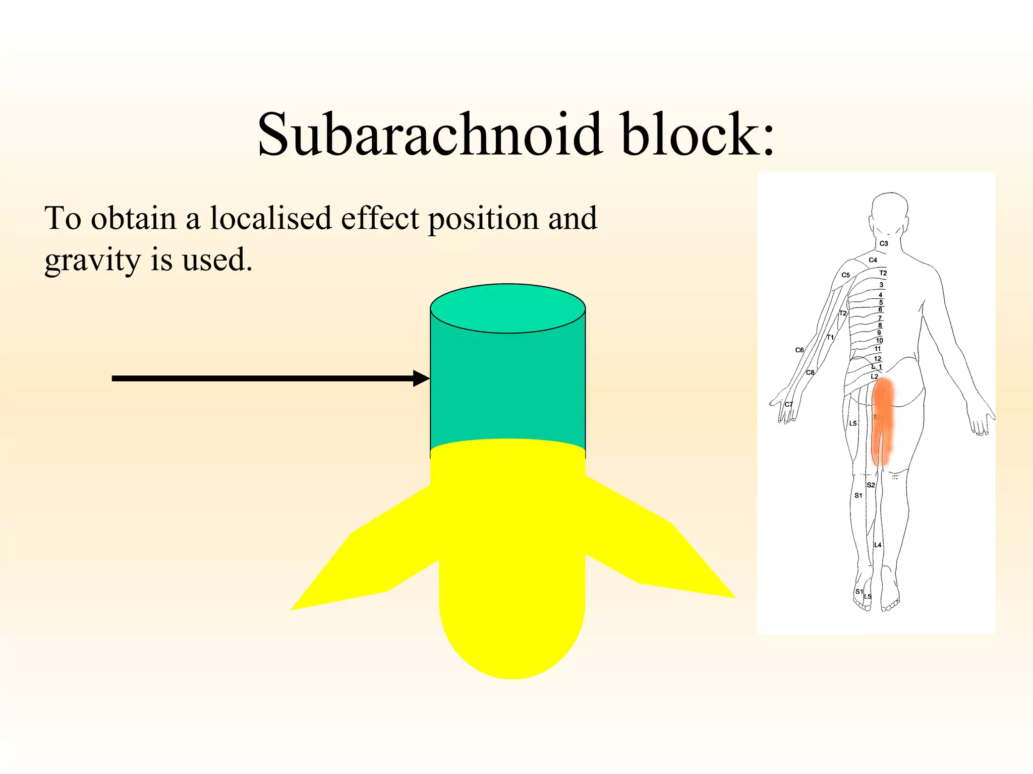 Subarachnoid block: To obtain a localised effect position and gravity is used. 