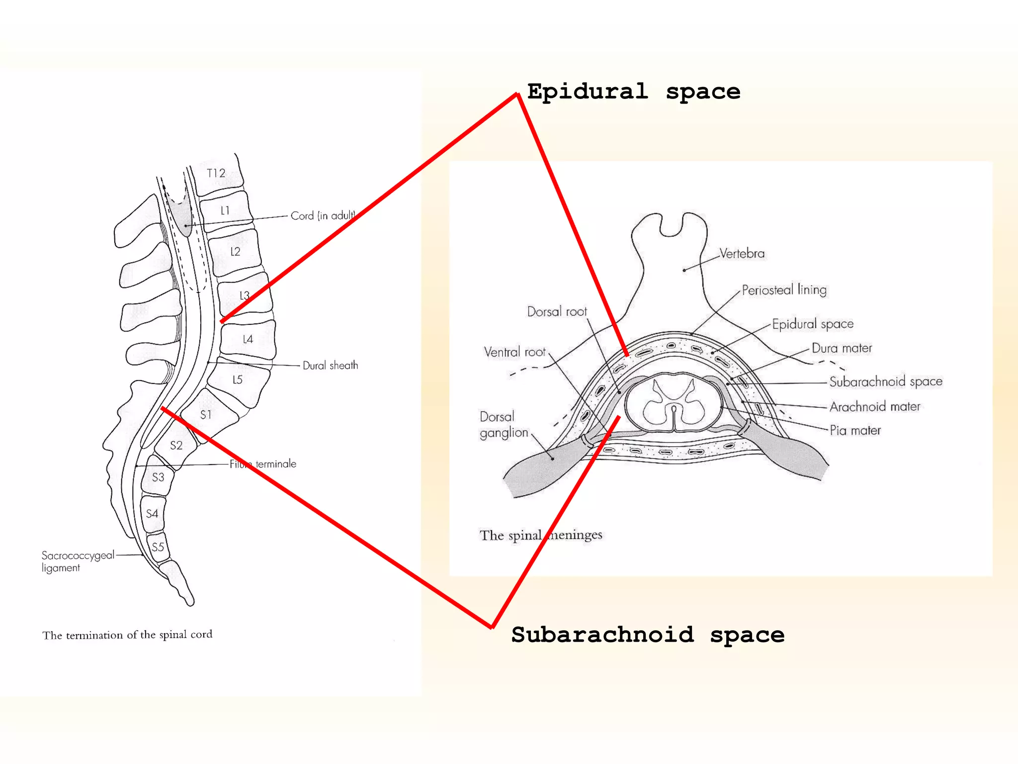 Epidural space Subarachnoid space 