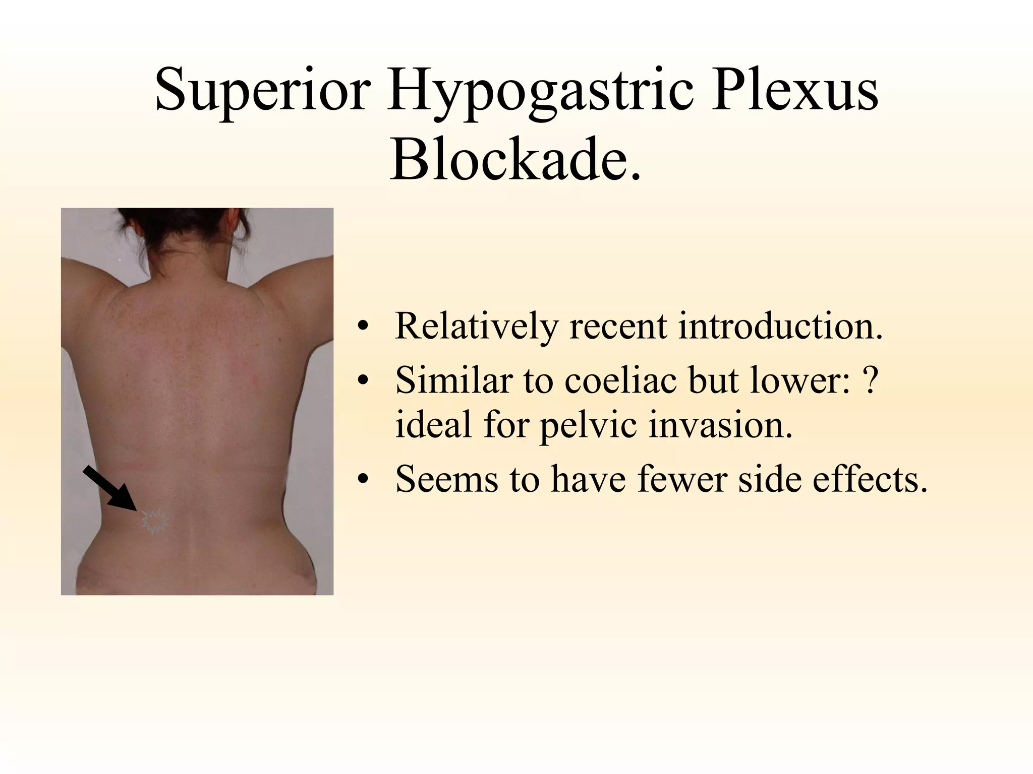 Superior Hypogastric Plexus Blockade. Relatively recent introduction.  Similar to coeliac but lower: ? ideal for pelvic invasion. Seems to have fewer side effects. 