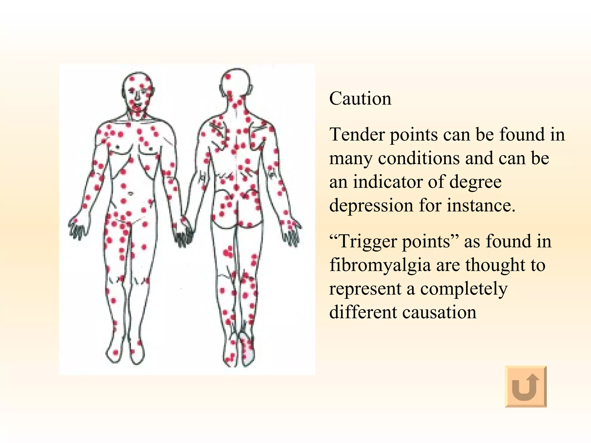 Caution Tender points can be found in many conditions and can be an indicator of degree depression for instance. “ Trigger points” as found in fibromyalgia are thought to represent a completely different causation 
