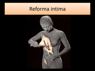 Reforma intima
 