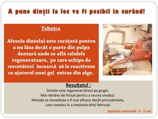 A pune dinţii la loc va fi posibil în curând!
Resultatul :
Dintele este regenerat direct pe gingie.
Mai rămâne de finisat pentru a recrea smalţul.
Metoda se dovedeşte a fi mai eficace decât precedentele,
care constau în a implanta dinţi fabricaţi.
Apariţie estimată: 3 - 5 ani
Tehnica 
Alveola dintelui este curăţată pentru
a nu lăsa decât o parte din pulpa
dentară unde se află celulele
regeneratoare, pe care echipa de
cercetători încearcă să le reactiveze
cu ajutorul unui gel extras din alge.
 