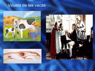 • Viruela de las vacas
 