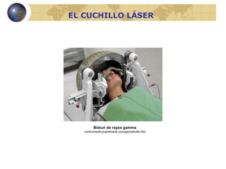 Bisturí de rayos gamma centromedicosaintmarie.com/gamaknife.htm EL CUCHILLO LÁSER 