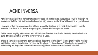 Acne Inversion INVERSES IN DERMATOLOGY skskskskkssk .pptx