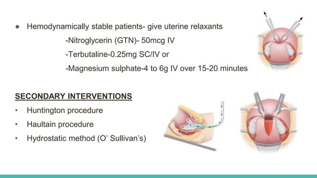 INVERSION OF THE UTERUS .pptx | Pregnancy | Reproductive Health