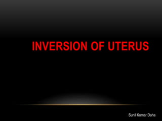 INVERSION OF UTERUS
Sunil Kumar Daha
 