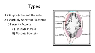 Types
1 ) Simple Adherent Placenta.
2 ) Morbidly Adherent Placenta :
i ) Placenta Accreta
ii ) Placenta Increta
iii) Placenta Percreta
 