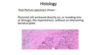 Histology
 Post Partum specimen shows :
Placental villi anchored directly on, or invading into
or through, the myometrium, without an intervening
decidual plate.
 