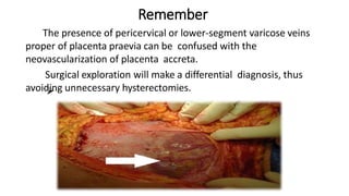 Remember

 The presence of pericervical or lower-segment varicose veins
proper of placenta praevia can be confused with the
neovascularization of placenta accreta.
Surgical exploration will make a differential diagnosis, thus
avoiding unnecessary hysterectomies.
 