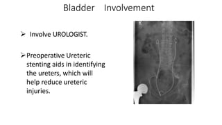 Bladder Involvement
 Involve UROLOGIST.
Preoperative Ureteric
stenting aids in identifying
the ureters, which will
help reduce ureteric
injuries.
 