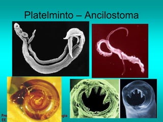 Platelminto – Ancilostoma 