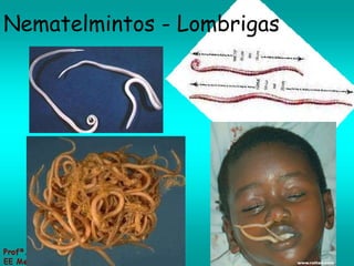 Nematelmintos - Lombrigas 