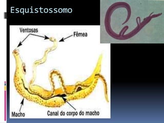 Esquistossomo
 