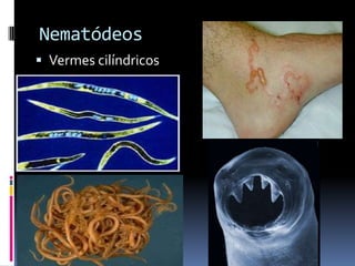 Nematódeos
 Vermes cilíndricos
 