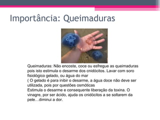 Importância: Queimaduras




    Queimaduras: Não encoste, coce ou esfregue as queimaduras
    pois isto estimula o desarme dos cnidócitos. Lavar com soro
    fisiológico gelado, ou água do mar
    ( O gelado é para inibir o desarme, a água doce não deve ser
    utilizada, pois por questões osmóticas
    Estimula o desarme e consequente liberação da toxina. O
    vinagre, por ser ácido, ajuda os cnidócitos a se soltarem da
    pele…diminui a dor.
 