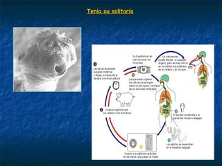 Tenia ou solitaria
 