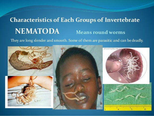 Invertebrates