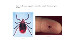 Figure 11.18 Ixodes scapularis transmits the bacteria that causes Lyme
disease.
 