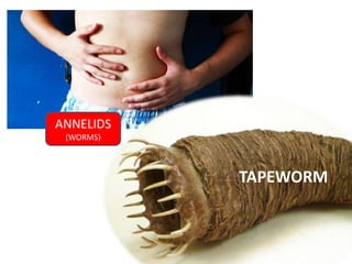 ANNELIDS 
(WORMS) 
TAPEWORM 
 