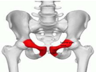 Invertogram ANORECTAL MALFORMATION ( ARM ) PRANAYA | PPTX