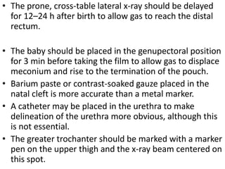 Invertogram ANORECTAL MALFORMATION ( ARM ) PRANAYA | PPTX